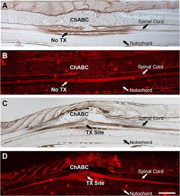 Chondroitinase ABC Promotes Axon Regeneration and Reduces Retrograde Apoptosis Signaling in Lamprey